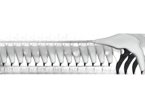 Tacknet — Endoscopic Mesh Tacker