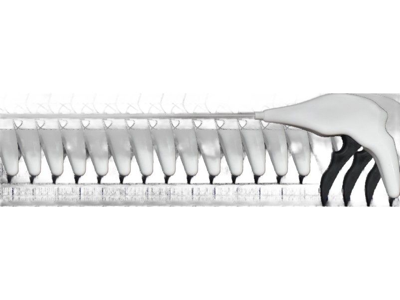 Tacknet — Endoscopic Mesh Tacker, sterile surgical device by Suture Planet